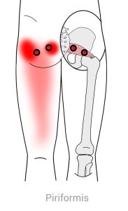 piriformis dry needling